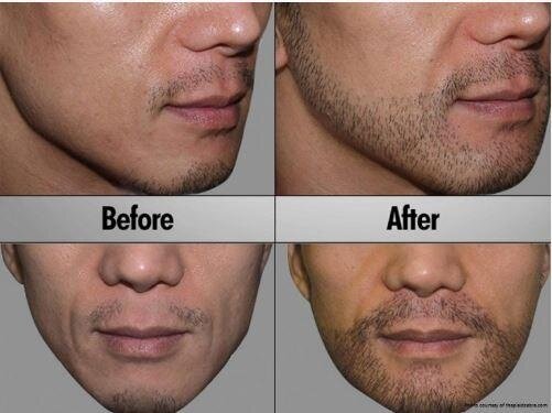 cg beard growth kit