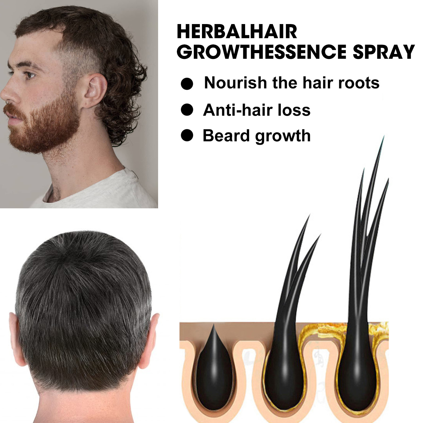 Haarwachstum Set 2-teilig – Serum & Roller Gegen Haarausfall, Mit Ginseng & Ingwer