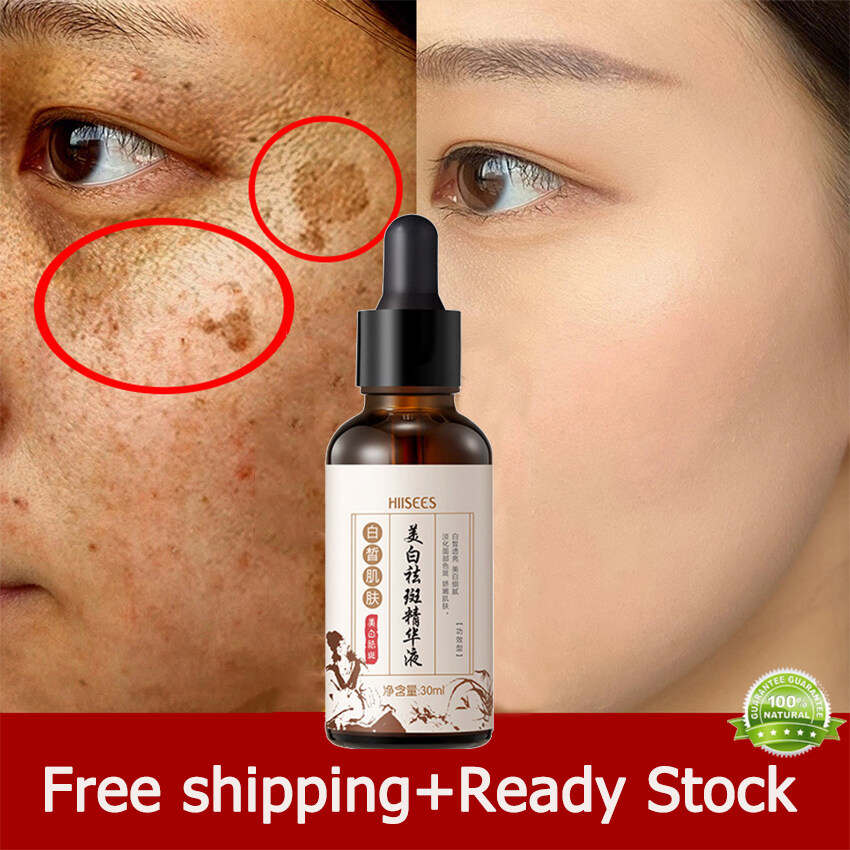 Serum Làm Trắng Da Mặt Trị Tàn Nhang Trị Thâm Nám Loại Bỏ Mạnh Mẽ Chloasma Melanin Làm Mờ Vết Thâm Nám Dưỡng Ẩm Làm Sáng Da Mặt Tinh Chất Chăm Sóc Da 30Ml