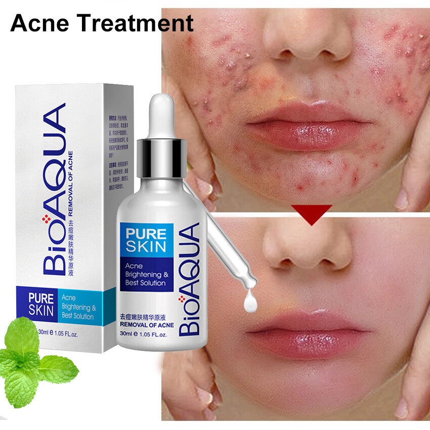 BioAQUA Điều Trị Mụn Chất Loại Bỏ Sẹo Mụn Lỏng Đốm Mụn Da Mặt CareSerum Làm Trắng Giữ Ẩm 30Ml