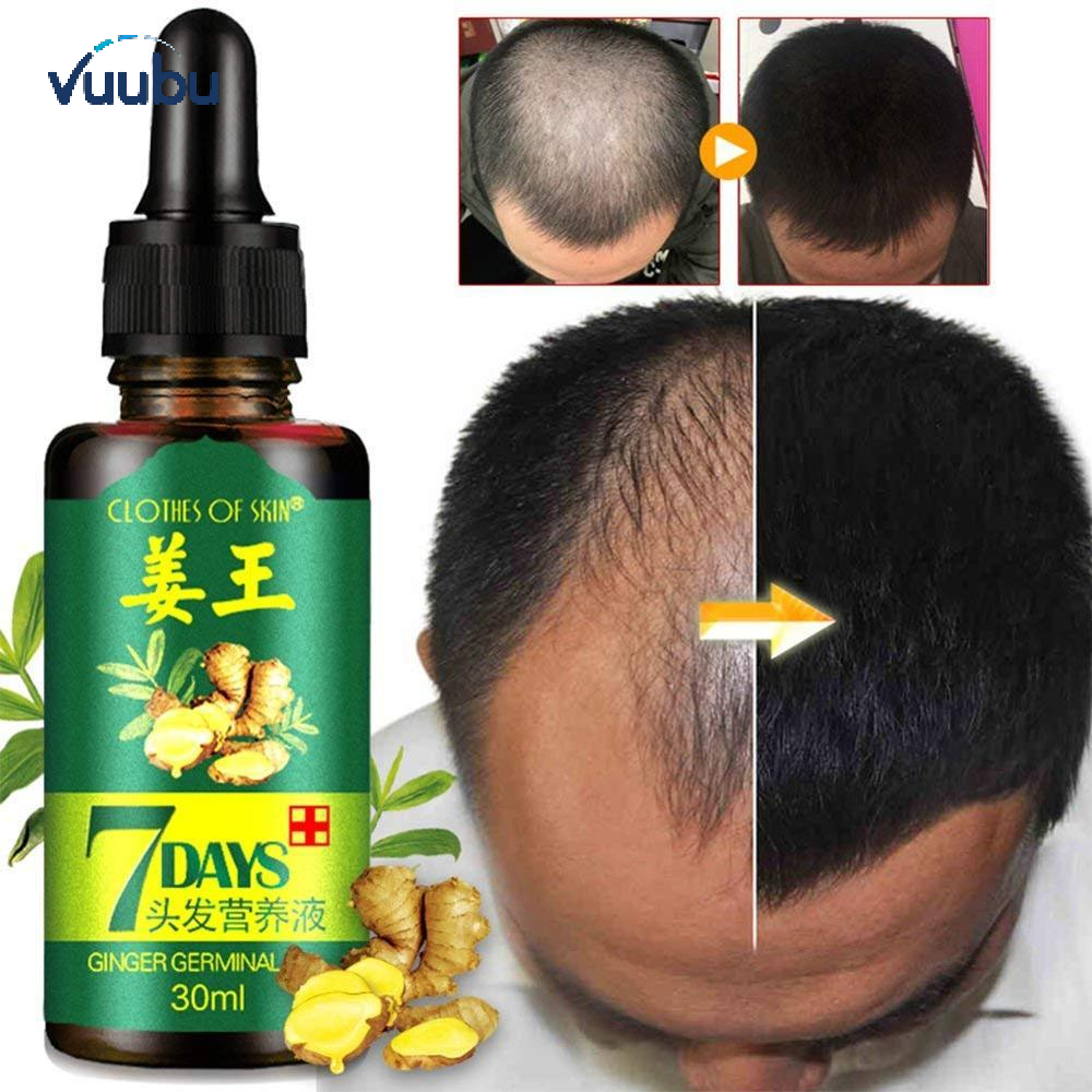Vuubu dầu mầm gừng eelhoe tinh dầu mọc tóc chăm sóc tóc trị rụng tóc serum mọc tóc dầu mọc tóc, bổ tóc sửa chữa nang lông cho nam và nữ 50ml