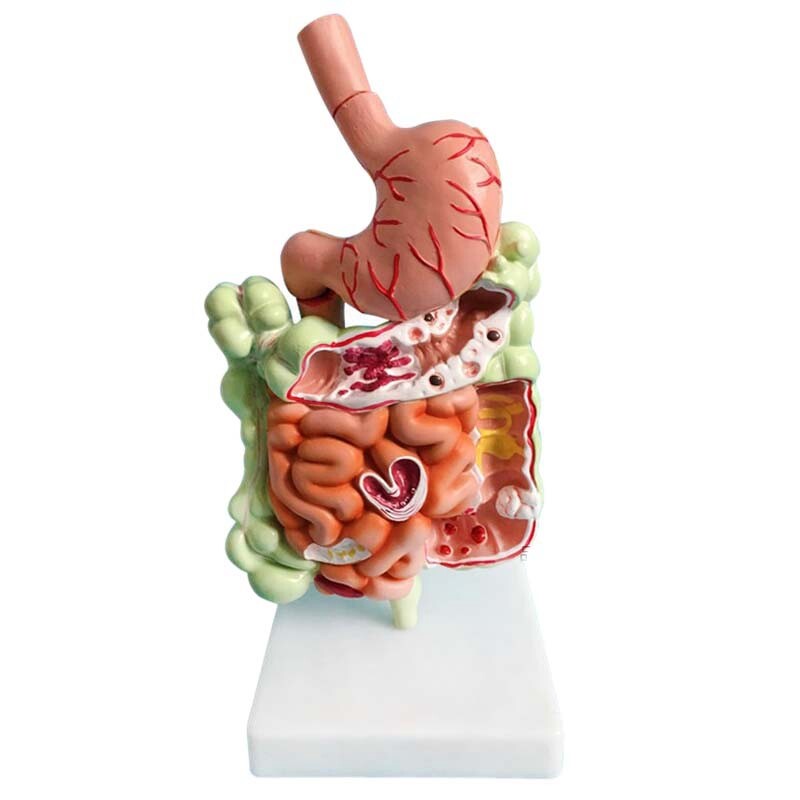 Human Digestive System Model Stomach Anatomy Large Intestine Cecum Rectum