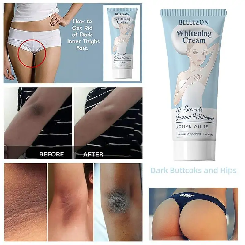 inner thigh bleaching