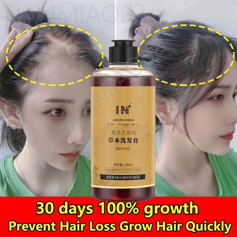 Dầu gội thảo dược đen tóc polygonum multiflorum 500ml dung dịch mọc tóc dầu gội chống rụng tóc