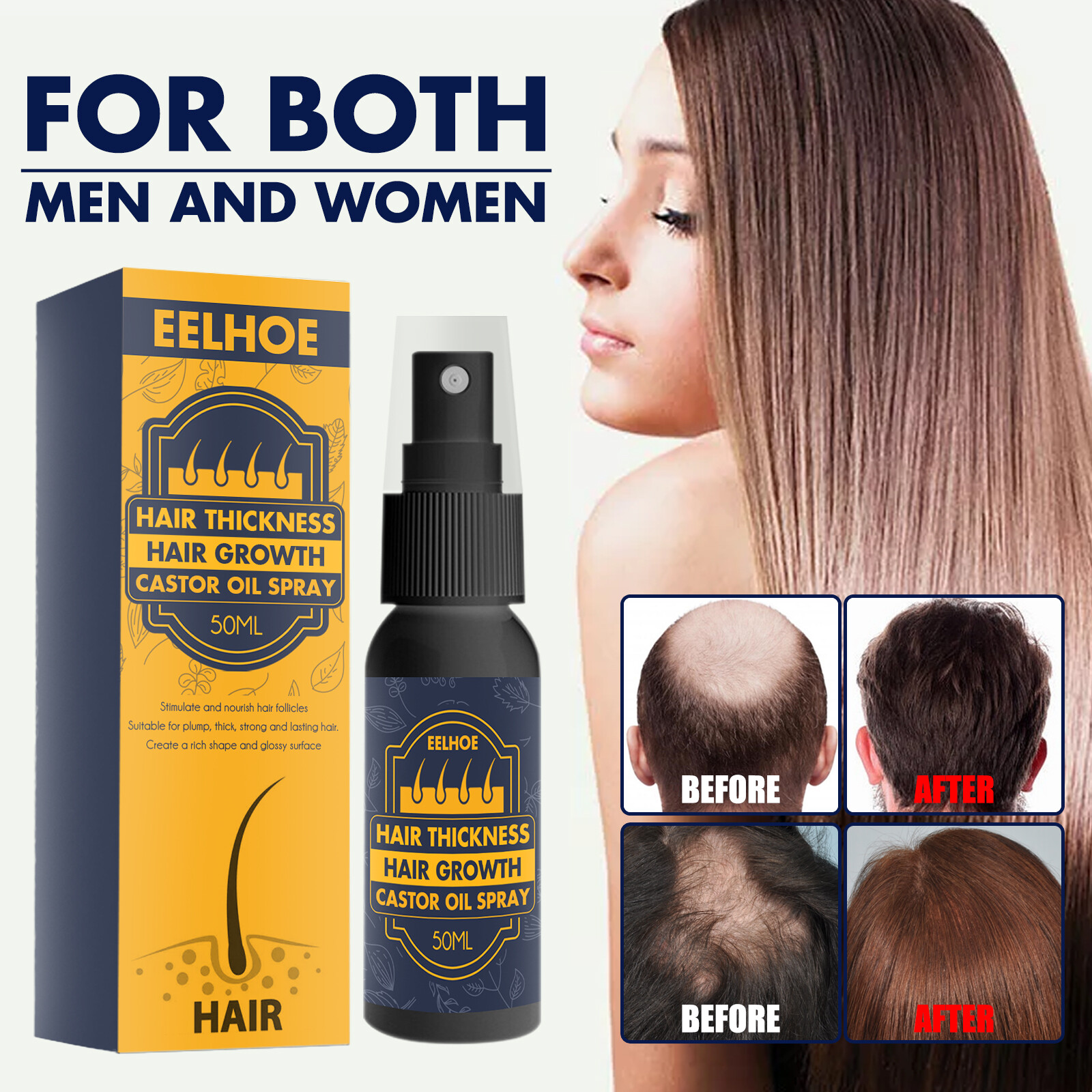 Eelhoe dầu thầu dầu xịt mọc tóc điều trị rụng tóc chăm sóc tóc hư tổn cho nam nữ mọc tóc nhanh phù hợp với mọi kiểu tóc