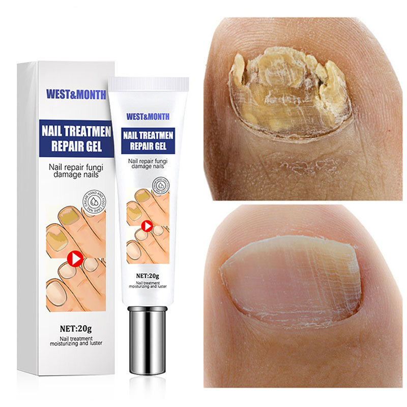 LaMart Store Kem Sửa Móng Kháng Khuẩn Móng Tay Trị Nấm Móng 20G Thuốc Mỡ Chăm Sóc Móng Kem Làm Móng Dày Mềm