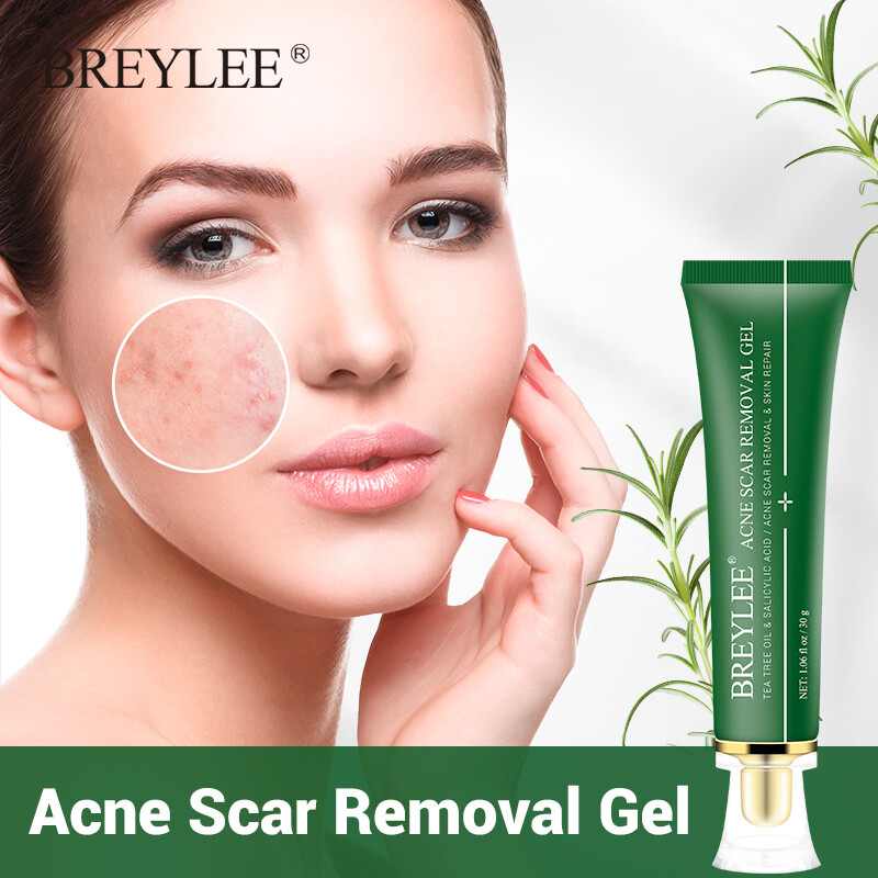 BREYLEE Gel loại bỏ sẹo mụn 30g Kem điều  mụn