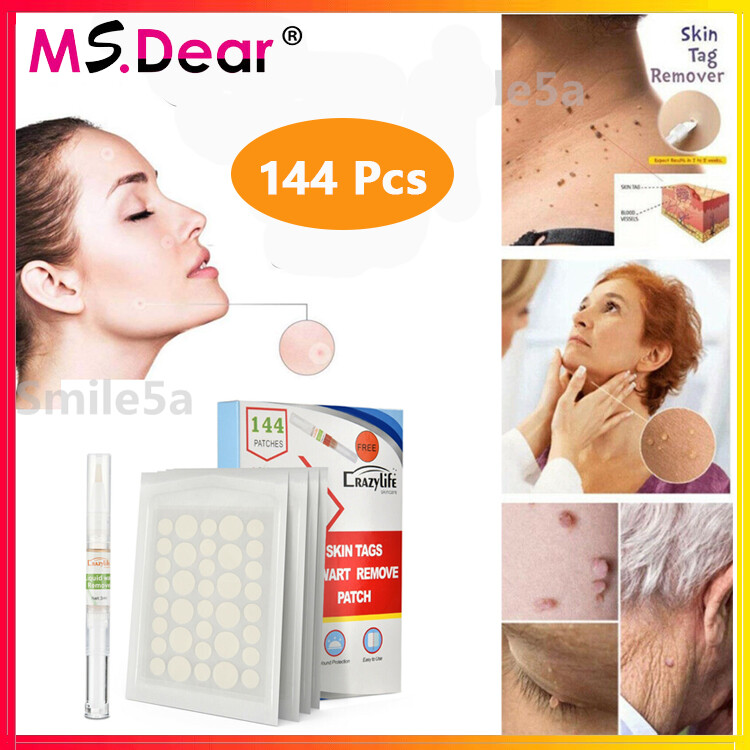 144 Miếng Dán Miếng Dán Nốt Ruồi Loại Bỏ Nốt Ruồi Mụn Cóc Que Ngô Điều Trị, Miếng Dán Tẩy Da Chống Nhiễm Trùng Dung Dịch Thẩm Mỹ Viện Không Đau