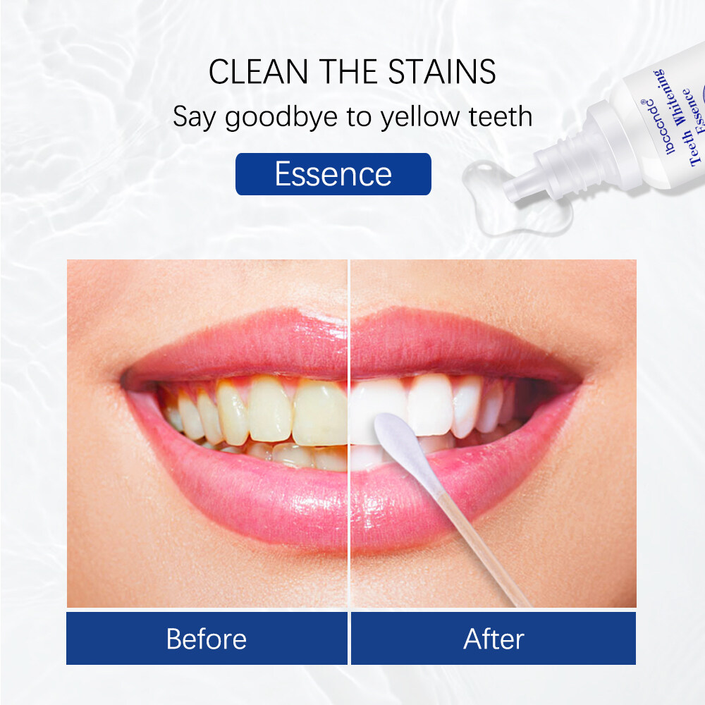 ibcccndc 10ml Teeth Whitening Essence Tooth Brighten Liquid With Cotton