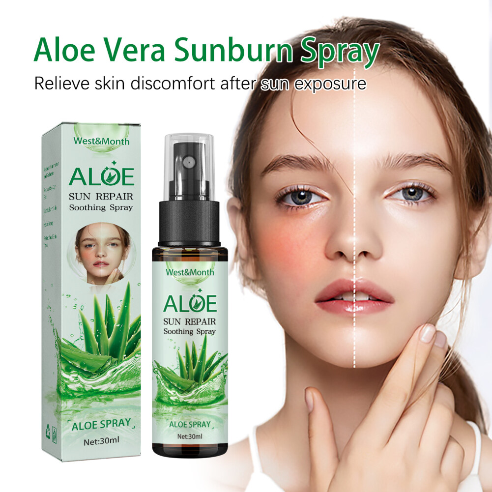 spray aloe for sunburn