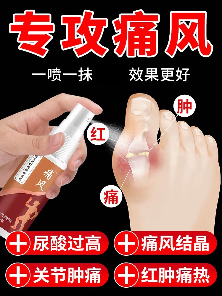 Nanjing Tongrentang Gout Cold Compress Gel Special Spray Foot Joint Pain Relief Artifact Special Drug Nemesis Plaster Gout God Plaster
