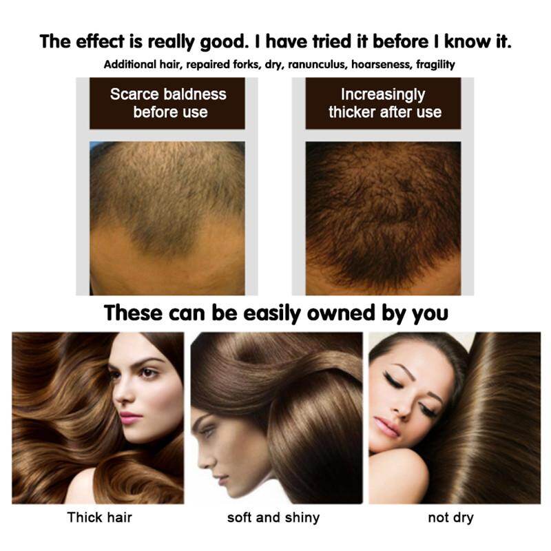 Share 124+ b12 deficiency hair loss reversible latest tnbvietnam.edu.vn