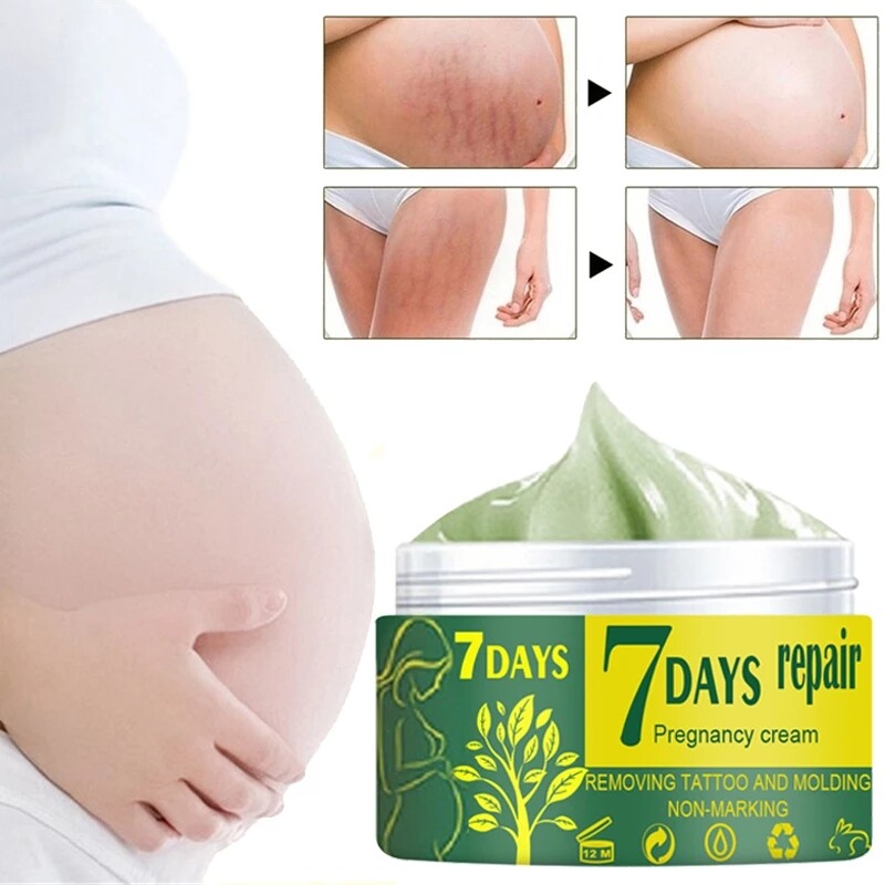 Kem phục hồi thai kỳ 10/30/50g kem trị rạn da trị rạn da vết sẹo rạn da kem dưỡng cơ thể trị mụn trứng cá