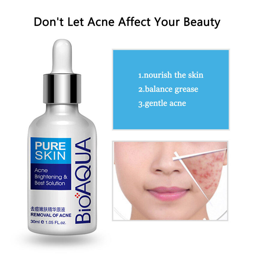 Tinh chất trị mụn bioaqua, dung dịch xóa sẹo mụn serum chăm sóc da mặt đốm mụn, làm trắng dưỡng ẩm 30ml