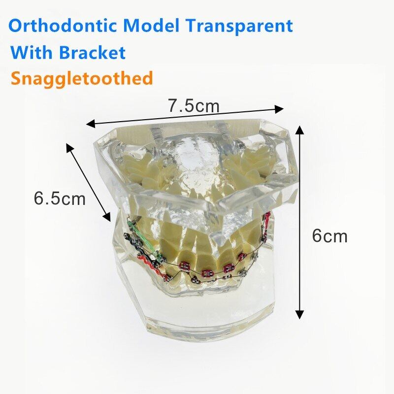 Jiayi Dental Model Transparent Orthodontics Treatment Model Teeth Study