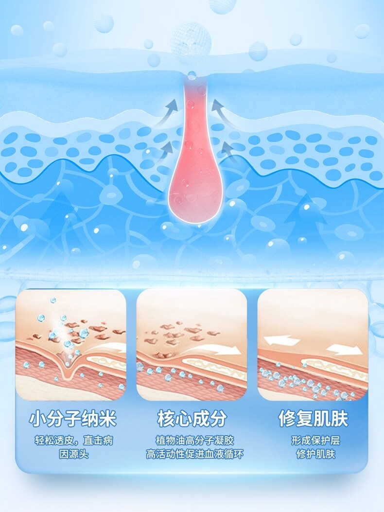 Gout cold compress gel joint pain special new version of special effect ointment uric acid non-boutique stickers to cure the gods to reduce nemesis Gout god stickers