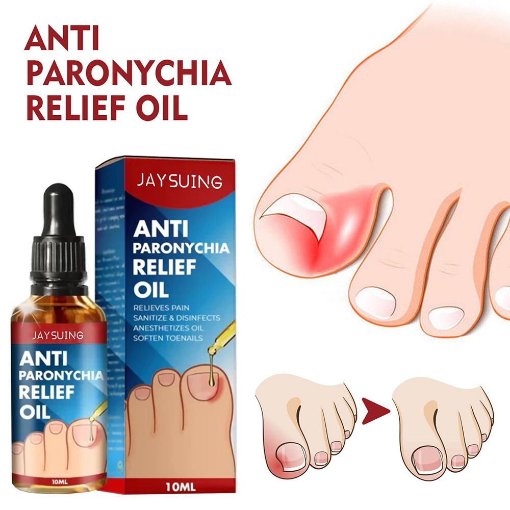 10Ml Hot Chống-Móng Tay Rãnh An Toàn Hữu Ích Chống Paronychia Relief Dầu Móng Tay Tăng Trưởng Chăm Sóc Móng Tay Dầu Sửa Chữa chăm sóc móng chân Dầu