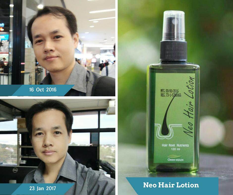 Purchase Wholesale Neo Hair Lotion Hair Growth Solution Original  Thaiproduct Murah from Trusted Suppliers in Malaysia 