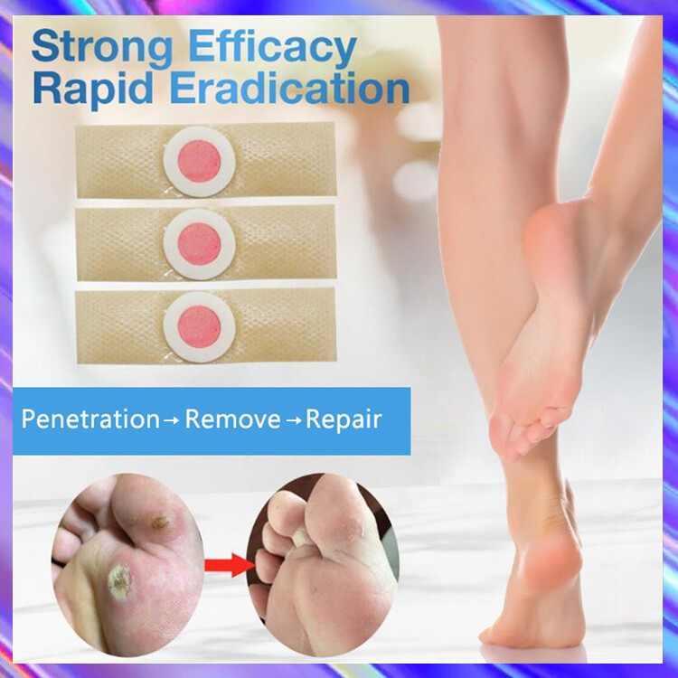 Bộ 42 miếng dán ngô giúp giảm đau trị mụn cóc vết chai lột da chết trên chân Romyse  - INTL