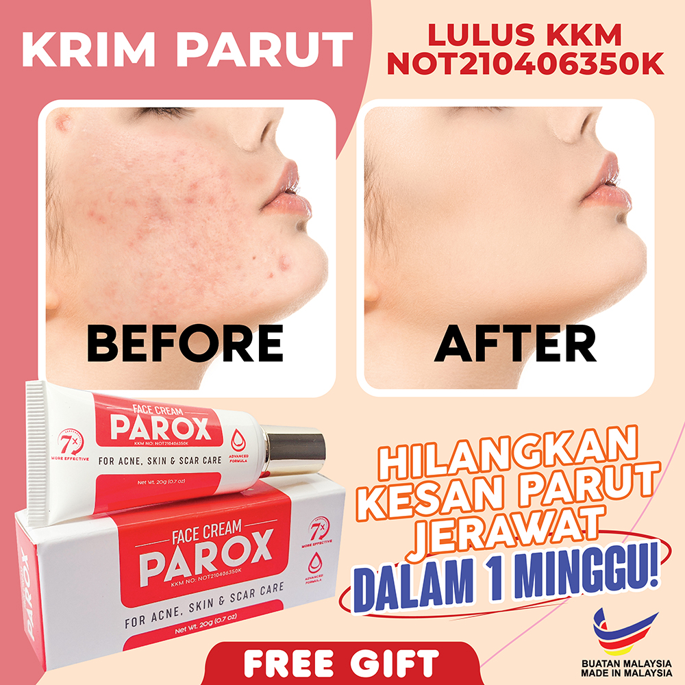 Krim Ubat Parut Lulus Kkm Krim Parut Klinik Pakar Kulit Berkesan Parut Hitam Parut Pih Acne Spot Cream Jerawat Scar Acne Pudar Berlubang Ubat Jkecut Jerawat Ubat Cerah Kulit