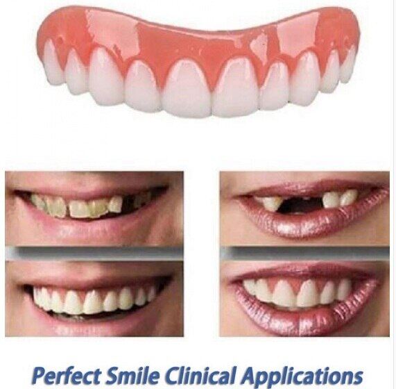 Hàm răng giả trên + dưới hàm răng giả khay răng trắng hoàn hảo, dụng cụ tập răng