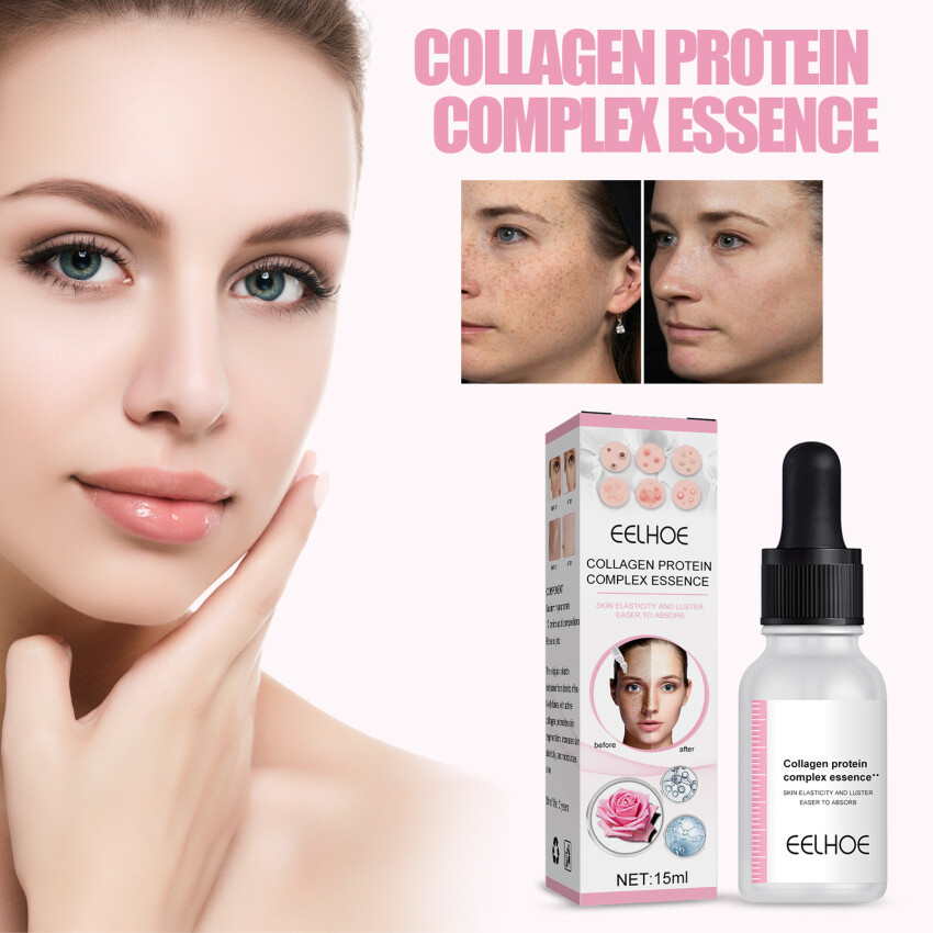 Serum collagen nhau thai cừu serum sửa da mụn kelikelipan serum sửa da mụn serum sửa da mụn cao cấp